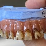 SFX Zähne Dental Effekte Neandertaler movieSFX