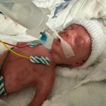 Frühchen Baby Dummie aus Silikon 24 SSW SFX mit Atembewegung Brust, Bauch, Kopf und Gliedmaßen durch Puppenspieler bewegbar movieSFX Spezialeffekte