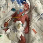 Frühchen Baby Dummie aus Silikon 24 SSW SFX mit Atembewegung Brust, Bauch, Kopf und Gliedmaßen durch Puppenspieler bewegbar movieSFX Spezialeffekte