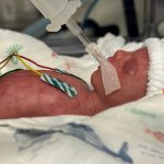 Frühchen Baby Dummie aus Silikon 24 SSW SFX mit Atembewegung Brust, Bauch, Kopf und Gliedmaßen durch Puppenspieler bewegbar movieSFX Spezialeffekte