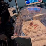 Frühchen Baby Dummie aus Silikon 24 SSW SFX mit Atembewegung Brust, Bauch, Kopf und Gliedmaßen durch Puppenspieler bewegbar movieSFX Spezialeffekte