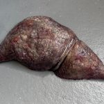 SFX Silikon Leber / für Rechtsmedizin, Krimi leberzirrhose , Requisit Film TV Prop movieSFX